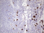 KIT Antibody in Immunohistochemistry (Paraffin) (IHC (P))