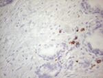 KIT Antibody in Immunohistochemistry (Paraffin) (IHC (P))