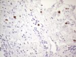 KIT Antibody in Immunohistochemistry (Paraffin) (IHC (P))