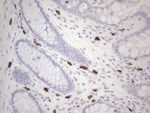 KIT Antibody in Immunohistochemistry (Paraffin) (IHC (P))