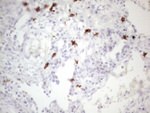 KIT Antibody in Immunohistochemistry (Paraffin) (IHC (P))