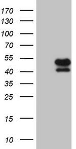 KLF2 Antibody in Western Blot (WB)