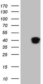 KLF2 Antibody in Western Blot (WB)