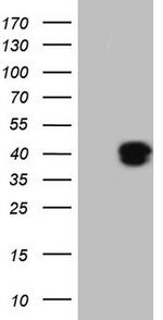 KLF2 Antibody in Western Blot (WB)