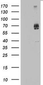 KLHL12 Antibody in Western Blot (WB)