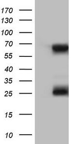 KLHL12 Antibody in Western Blot (WB)