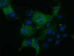 KLHL2 Antibody in Immunocytochemistry (ICC/IF)