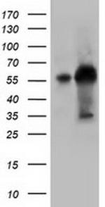 KLHL2 Antibody in Western Blot (WB)