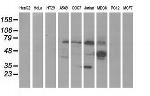 KLHL2 Antibody in Western Blot (WB)