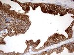 KLK2 Antibody in Immunohistochemistry (Paraffin) (IHC (P))