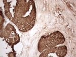 KLK3 Antibody in Immunohistochemistry (Paraffin) (IHC (P))