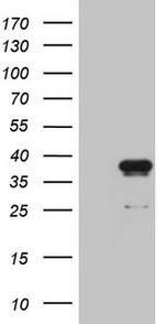 KLK3 Antibody in Western Blot (WB)