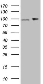 KPNB1 Antibody in Western Blot (WB)