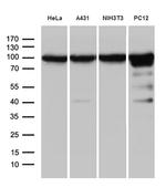 KPNB1 Antibody in Western Blot (WB)