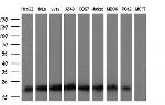 KRAS Antibody in Western Blot (WB)