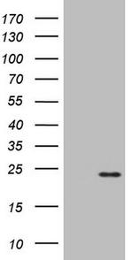 KRAS Antibody in Western Blot (WB)