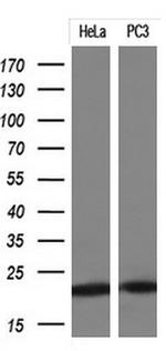 KRAS Antibody in Western Blot (WB)