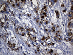 KRT14 Antibody in Immunohistochemistry (Paraffin) (IHC (P))