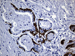 KRT14 Antibody in Immunohistochemistry (Paraffin) (IHC (P))