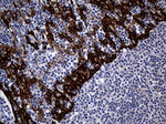 KRT14 Antibody in Immunohistochemistry (Paraffin) (IHC (P))