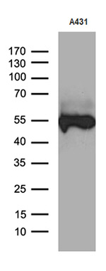 KRT14 Antibody in Western Blot (WB)
