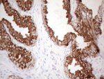 KRT16 Antibody in Immunohistochemistry (Paraffin) (IHC (P))