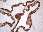 KRT16 Antibody in Immunohistochemistry (Paraffin) (IHC (P))