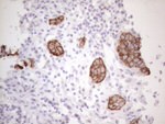 KRT16 Antibody in Immunohistochemistry (Paraffin) (IHC (P))