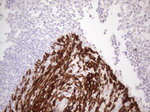 KRT16 Antibody in Immunohistochemistry (Paraffin) (IHC (P))