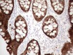 KRT16 Antibody in Immunohistochemistry (Paraffin) (IHC (P))