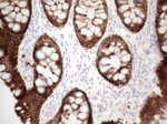 KRT16 Antibody in Immunohistochemistry (Paraffin) (IHC (P))