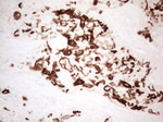 KRT16 Antibody in Immunohistochemistry (Paraffin) (IHC (P))