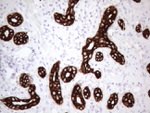 KRT16 Antibody in Immunohistochemistry (Paraffin) (IHC (P))