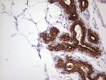 KRT16 Antibody in Immunohistochemistry (Paraffin) (IHC (P))