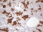 KRT16 Antibody in Immunohistochemistry (Paraffin) (IHC (P))