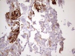 KRT16 Antibody in Immunohistochemistry (Paraffin) (IHC (P))