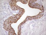 KRT16 Antibody in Immunohistochemistry (Paraffin) (IHC (P))