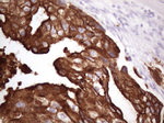 KRT16 Antibody in Immunohistochemistry (Paraffin) (IHC (P))