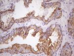 KRT16 Antibody in Immunohistochemistry (Paraffin) (IHC (P))