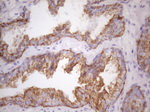 KRT16 Antibody in Immunohistochemistry (Paraffin) (IHC (P))