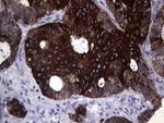 KRT16 Antibody in Immunohistochemistry (Paraffin) (IHC (P))