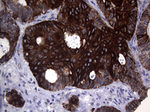 KRT16 Antibody in Immunohistochemistry (Paraffin) (IHC (P))