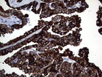 KRT16 Antibody in Immunohistochemistry (Paraffin) (IHC (P))