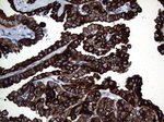 KRT16 Antibody in Immunohistochemistry (Paraffin) (IHC (P))