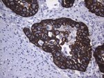 KRT16 Antibody in Immunohistochemistry (Paraffin) (IHC (P))