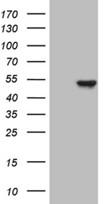 KRT16 Antibody in Western Blot (WB)