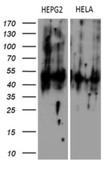 KRT16 Antibody in Western Blot (WB)