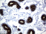 KRT18 Antibody in Immunohistochemistry (Paraffin) (IHC (P))