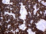 KRT18 Antibody in Immunohistochemistry (Paraffin) (IHC (P))