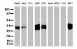 KRT18 Antibody in Western Blot (WB)